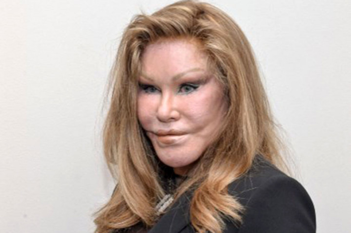 'Catwoman' Jocelyne Wildenstein Meninggal Dunia