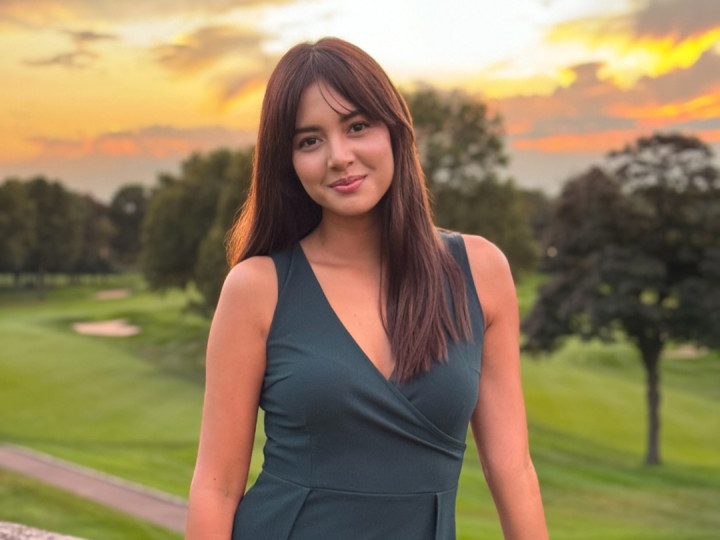 Kondisi Terkini Aurelie Moeremans Usai Alami Kecelakaan di Amerika