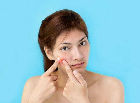 Mitos atau Fakta, Masturbasi Menyebabkan Jerawat!