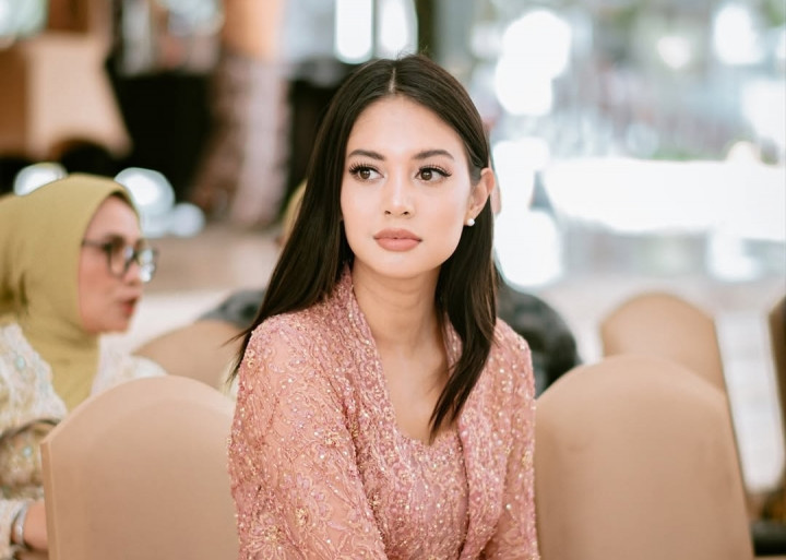 Aurelie Moeremans Alami Gegar Otak Akibat Kecelakaan di Amerika