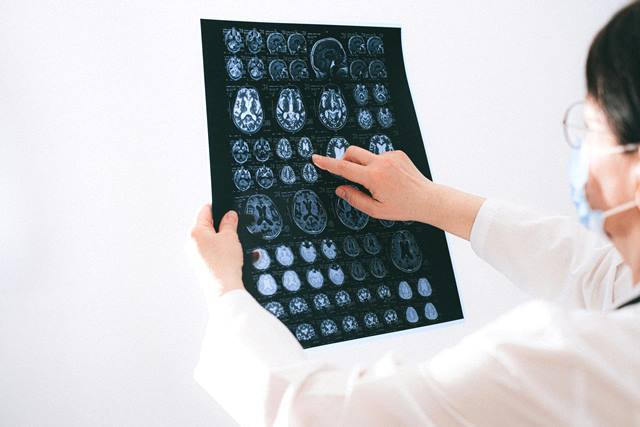 Ada hal lain yang bisa memicu stroke selain hipertensi. Yuk, simak selengkapnya di bawah ini. (Foto: Ilustrasi/Dok. Pexels.com)