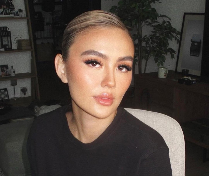 Sudah Ingatkan Promotor Bayar Royalti, Agnez Mo Heran Digugat Ari Bias