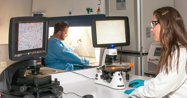 Golongan Darah Ini Lebih Berisiko Stroke di Usia Muda