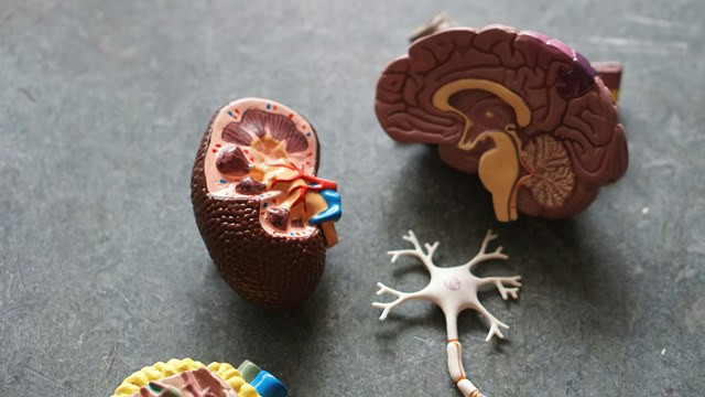 Dr. Alberth Ivan menjelaskan ada beberapa jenis senyawa kimia yang bisa menyebabkan pembentukan batu ginjal. (Foto: Ilustrasi/Dok. Unsplash.com)