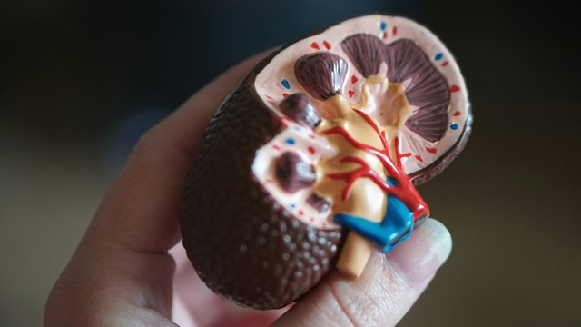  Penyebab gagal ginjal di usia muda salah satunya yaitu karena kurang minum air putih. (Foto: Ilustrasi/Dok. Pexels.com)