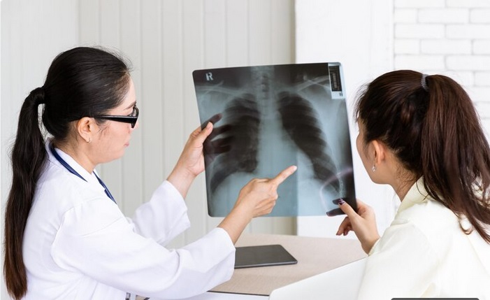 Kemenkes Sebut Penanggulangan TBC Perlu Pendekatan Holistik