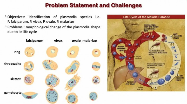BRIN Kembangkan Sistem Diagnosis Malaria Berbasis AI