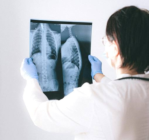 TBC Masih Tinggi, Nurhadi Minta Perbaiki Tata Kelola yang belum Optimal