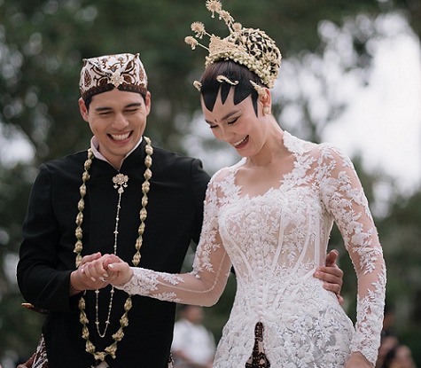 Sebelum menikah dengan Maxime, Luna Maya pernah melakukan Egg Freezing. Dok. Luna Maya Instagram