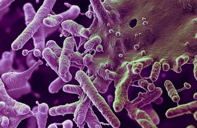 Antraks Mewabah di Thailand, Begini Cara Penularannya pada Manusia