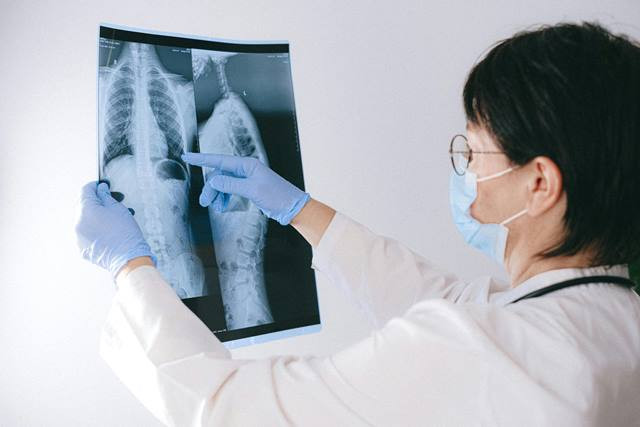 Menkes mengusulkan lomba kader penemu pasien TBC. (Foto: Ilustrasi/Dok. Pexels.com)