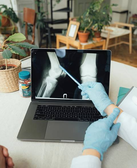 Sakit Lutut? Awas Kolagen Cenderung Berkurang Sejak Usia 25 Tahun