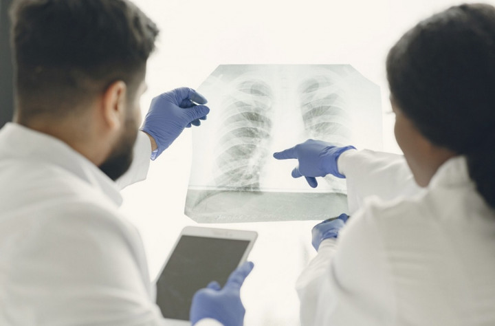 TBC Bukan Kasus Tiba-tiba, RSUD Ini Ungkap Setiap Minggu Menerima 4 Pasien