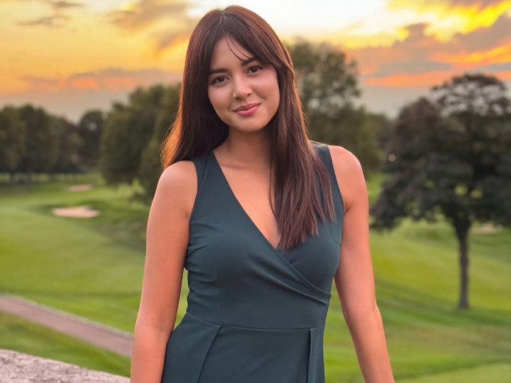 Efek Kecelakaan, Otak Aurelie Moeremans Alami Penyusutan