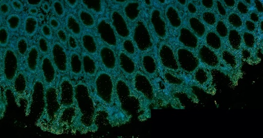 Menilik Transcriptomics Spasial, Potensi Revolusi Pengobatan Klinis