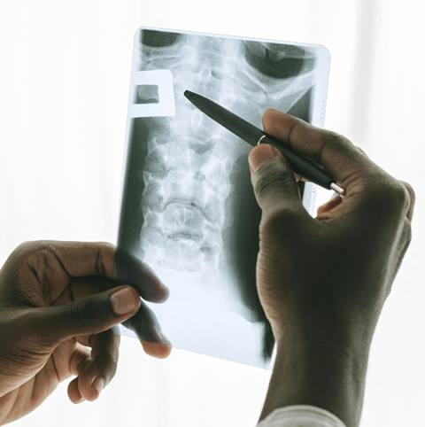 3 Berita Terpopuler Gaya: Saraf Terjepit Hingga Cara Simpan Daging Kurban