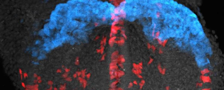 Ilmuwan Berhasil Merekam Pergerakan Sel Pembentukan Jantung