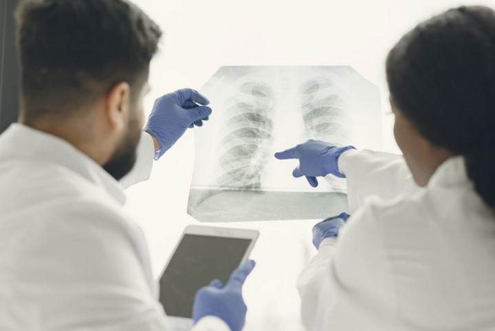 Pakar Beberkan Tantangan Meminimalisir Kasus TBC di Indonesia