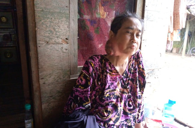 Program JKN Setia Menemani Wartasih Hadapi Gula Darah dan Tumor Ganas