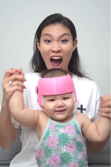  Zoe perlu menjalani terapi dengan helm khusus selama 23 jam. (Foto: Dok. Instagram Patricia Gouw/@patriciagouw)