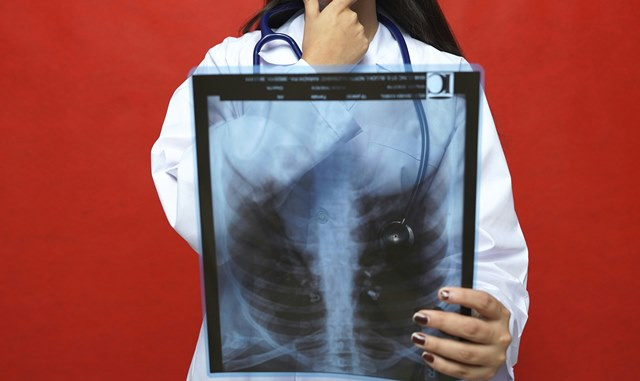 Kampung Siaga di Bekasi Jadi Model Eliminasi TBC