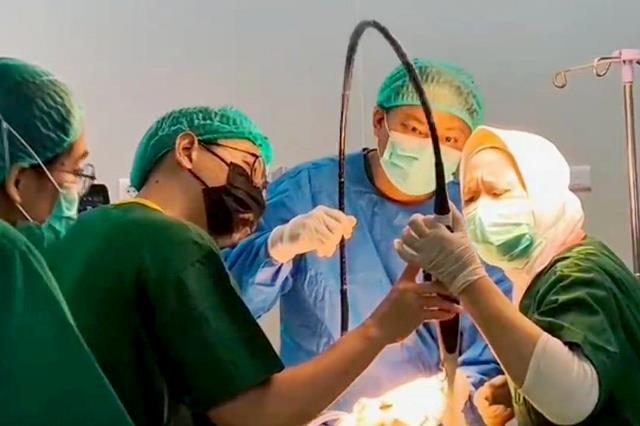 RSUD Undata Palu Laksanakan Operasi Jantung Terbuka Perdana