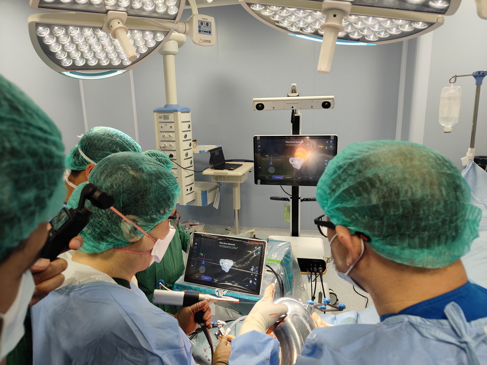 RS Mandaya Berhasil Operasi 100 Lutut dengan Robot Navigasi CORI (Foto: instagram)