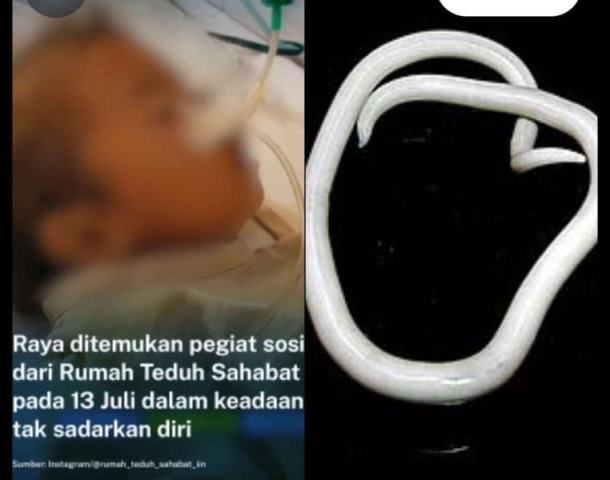   Balita bernama Raya di Sukabumi meninggal karena cacingan. (Foto: Dok. Istimewa)