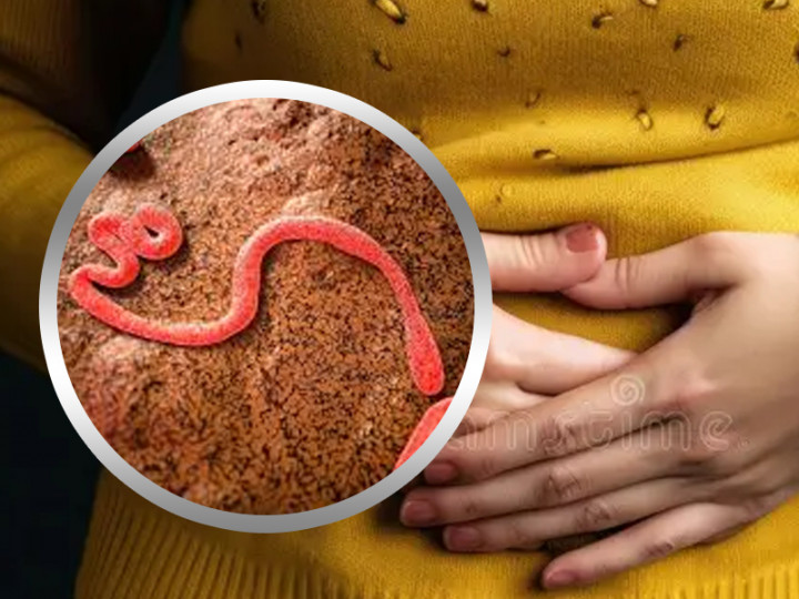 Penyebab Hingga Cara Mencegah Penyakit Cacingan