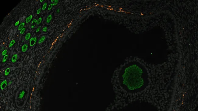 Penelitian Baru Ungkap Awal Terbentuknya Persediaan Sel Telur di Ovarium