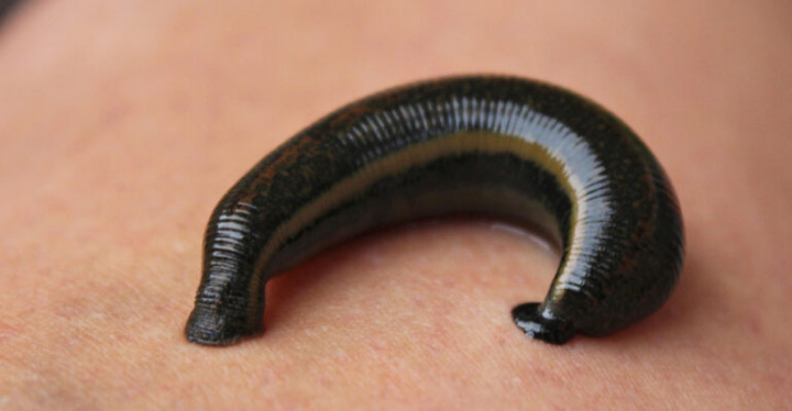 Mirip Tapi Tak Sama, Ini Perbedaan Lintah dan Siput Tanpa Cangkang