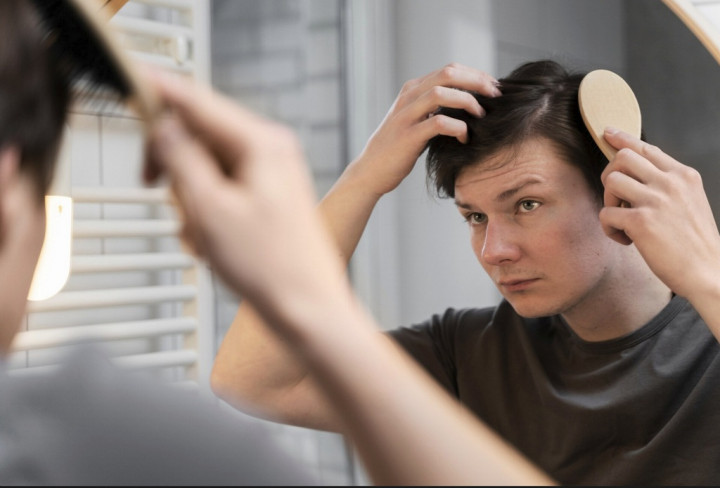 Studi: Minum Alkohol dan Soda Memengaruhi Rambut Rontok, Ini Penjelasannya