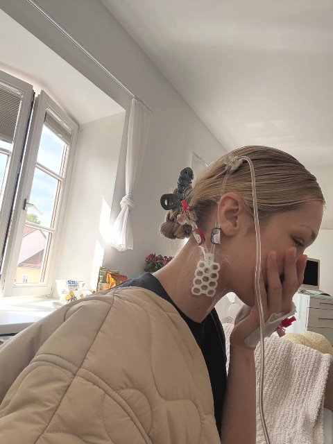  Dilansir dalam People, gejala yang dialami Bella Hadid sebenarnya sudah dirasakan dua tahun sebelumnya. (Foto: Dok. Instagram Bella Hadid/@bellahadid)