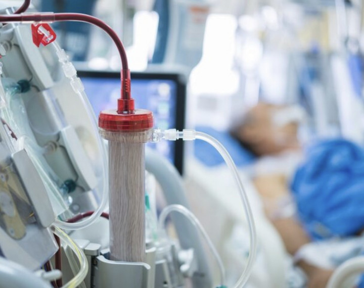 Mengenal Hemodialisis dan Terobosan Terbaru untuk Perawatan Gagal Ginjal Kronik