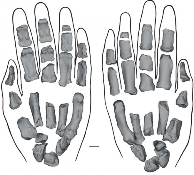 Fosil Paranthropus boisei yang ditemukan di Kenya. DOK Nature