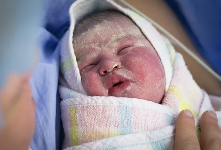 Mengenal Vernix Caseosa dan Peran Pentingnya dalam Kesehatan Kulit Bayi