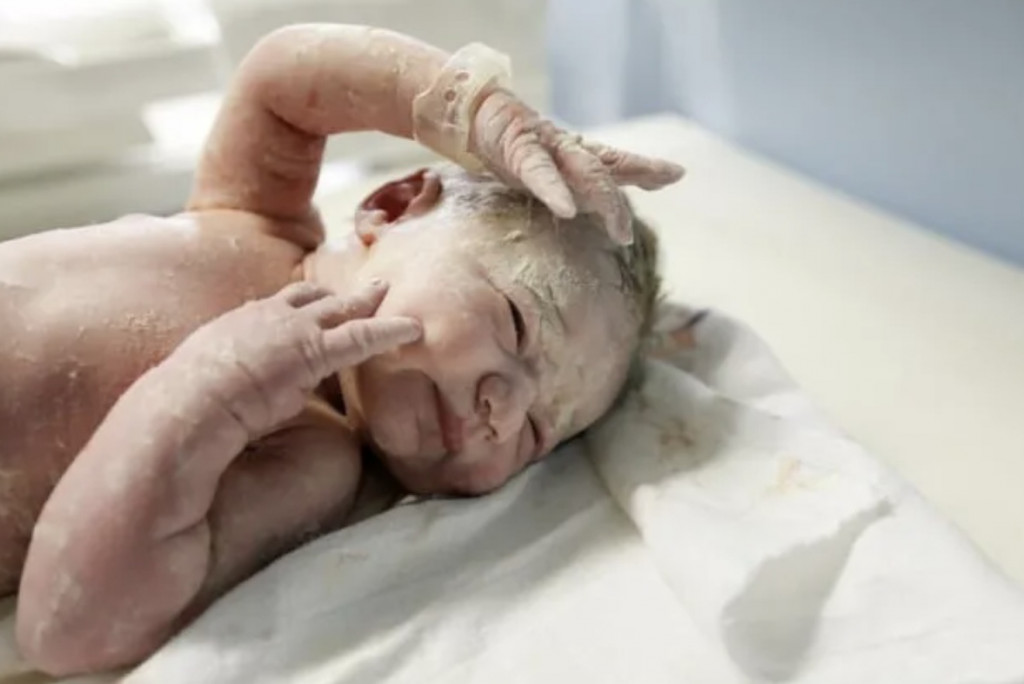 Vernix berfungsi sebagai penghalang untuk kulit sensitif bayi, mengunci kelembapan alami dan melindungi dari bakteri. Ilustrasi Hello Sehat