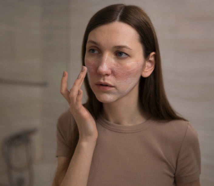 Jerawat adalah masalah kulit yang sering dialami banyak orang, terutama di usia remaja atau saat kulit sedang tidak stabil. Ilustrasi Freepik