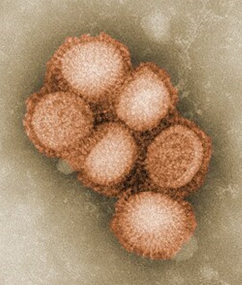  Kemenkes bersama pemerintah daerah mulai menyusun perbaikan lingkungan dan lainnya. (Foto: Dok. CDC Influenza Laboratory/Wikipedia)