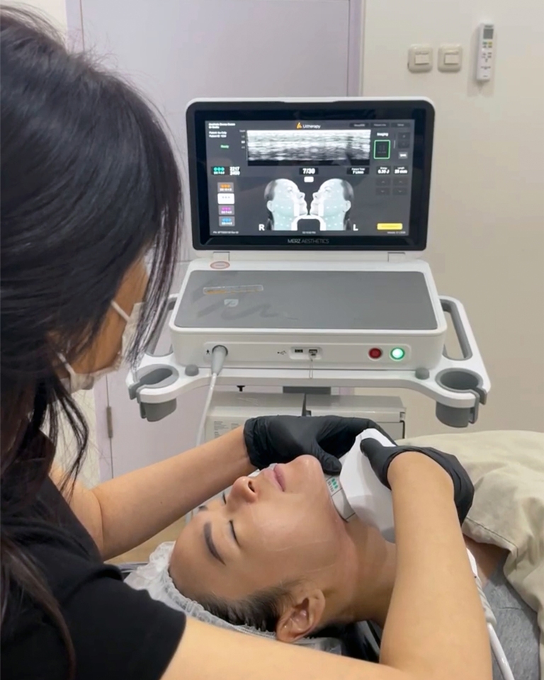 ADC Aesthetic Derma Centre Bandung resmi menghadirkan Ultherapy PRIME pertama dan satu-satunya di Bandung. Dok. Ist