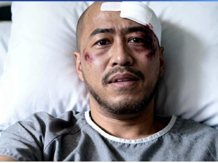 Benarkah Pandji Pragiwaksono Dibuat Babak Belur dan Ditangkap Polisi?