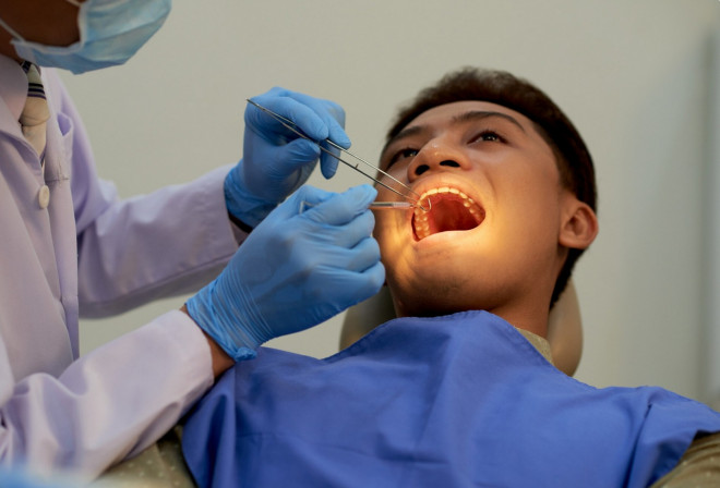 Secara umum, kegoyangan gigi pada orang dewasa dapat disebabkan oleh kondisi seperti; kecelakaan. Ilustraso Freepik