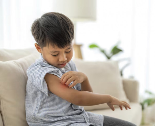 Campak lebih berbahaya jika dialami oleh bayi karena imunitas tubuhnya belum sempurna seperti orang dewasa. Ilustrasi Freepik