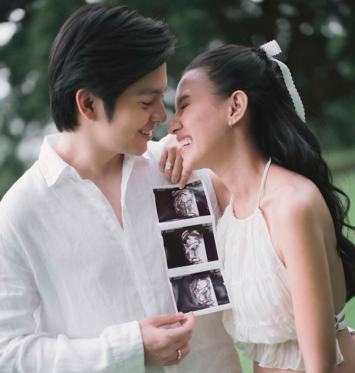 Rayakan Tahun Pertama Pernikahan, Angga Yunanda Umumkan Kehamilan Shenina Cinnamon