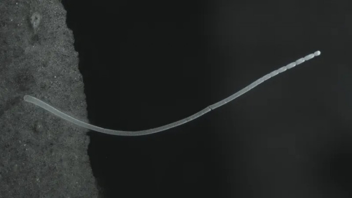 Tak Perlu Mikroskop, Ini Bakteri Terbesar di Dunia yang Ditemukan di Rawa