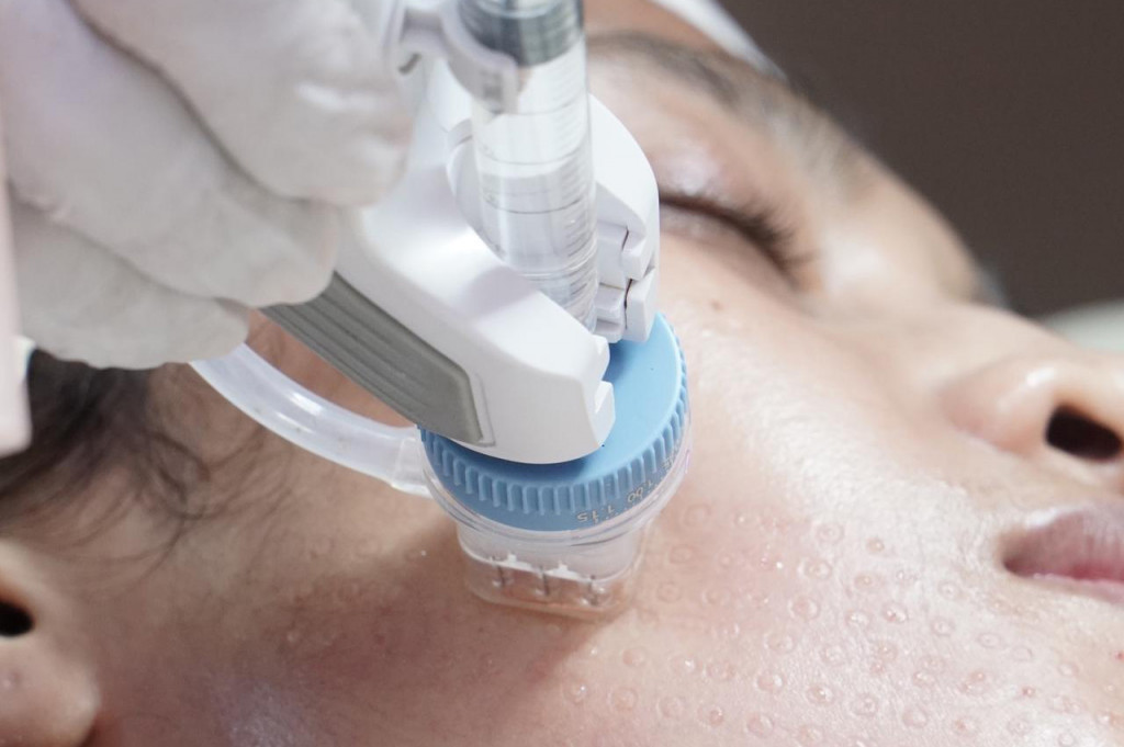 ​Remee Pro Diperkenalkan untuk Mendukung Prosedur Skinbooster