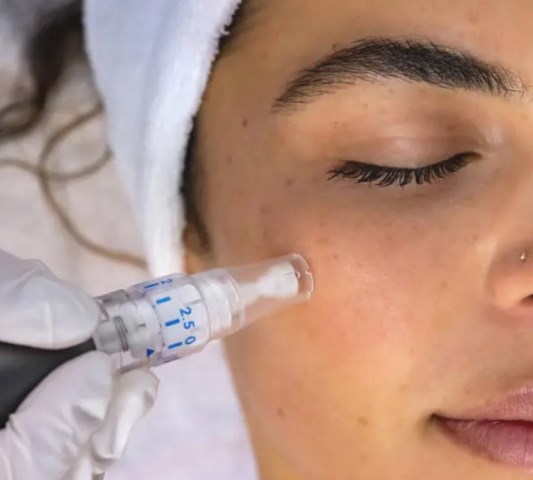 Viral Sih, tapi Yakin Mau Pakai Microneedling Serum? Cek Dulu Red Flag-nya!
