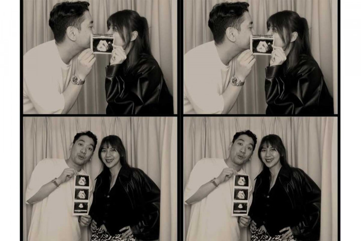 Adinda Thomas Hamil Anak Pertama, Unggah Momen USG hingga Photobox Bareng Suami