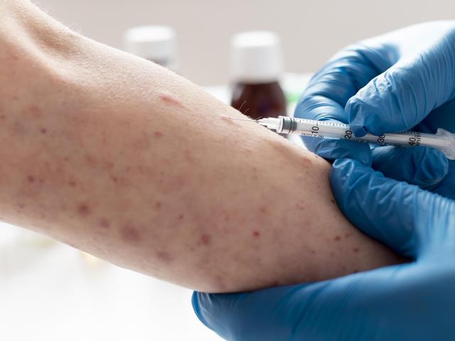 Kasus Campak Meningkat Jelang Mudik Lebaran 2026, Dosen UGM Imbau Ini