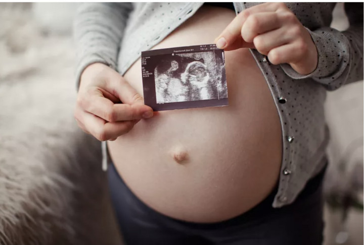 Kenali Gejala Hernia Umbilikal saat Hamil, Jangan Sampai Diabaikan